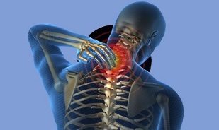 causes of cervical spine osteochondrosis