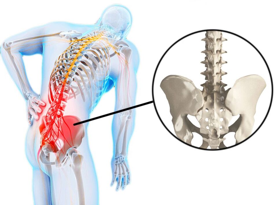 back pain