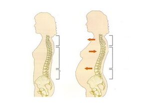 what can cause back pain